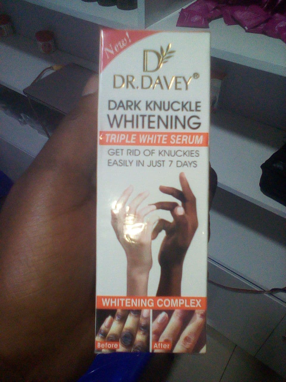 Dark Knuckle Whitening Cream